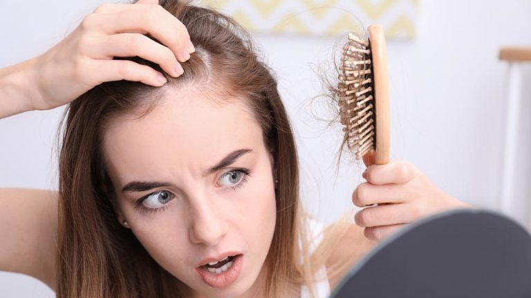 5 Foods To Avoid To Prevent Hair Loss